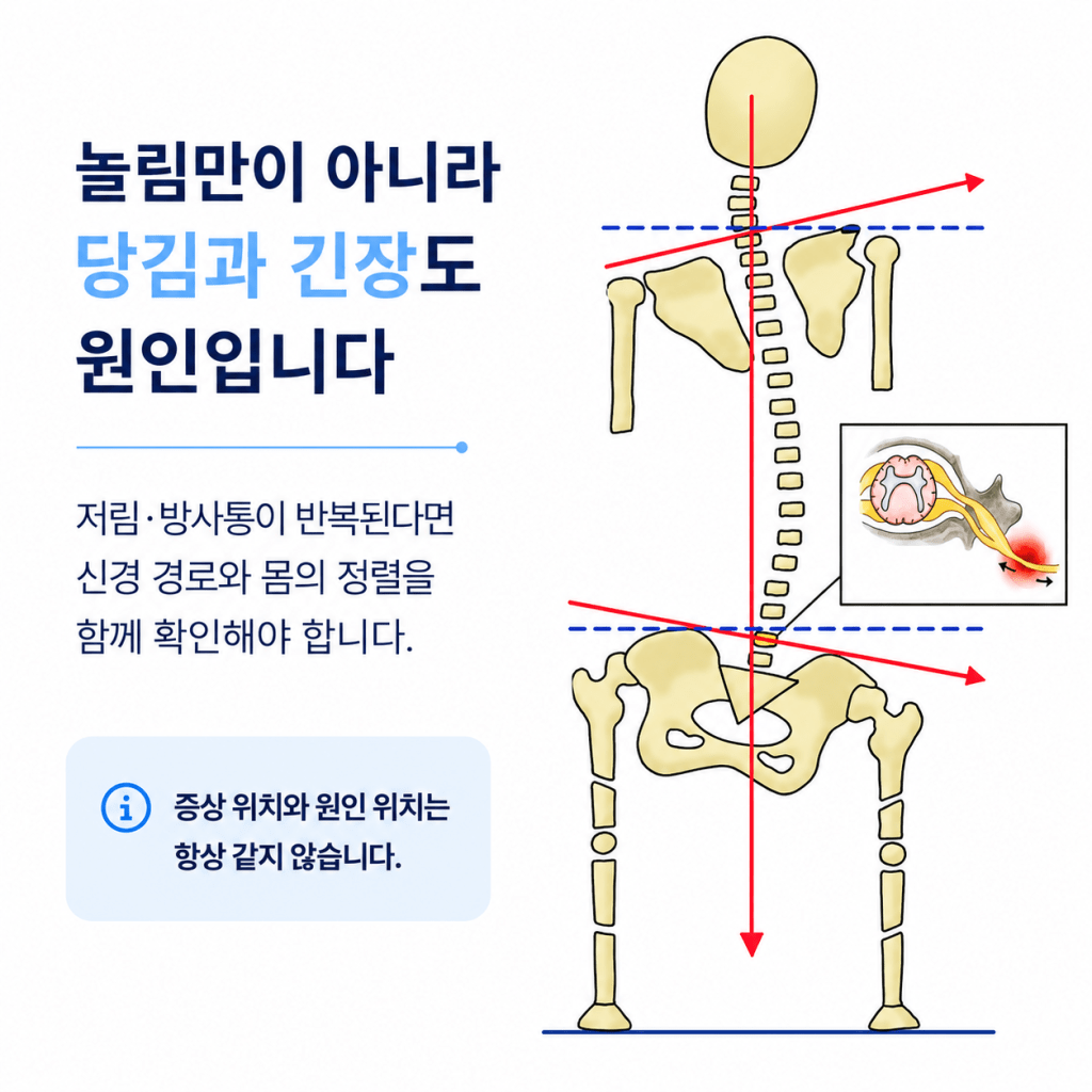 저림과 방사통이 반복될 때 신경 경로와 몸의 정렬을 함께 확인하는 이미지