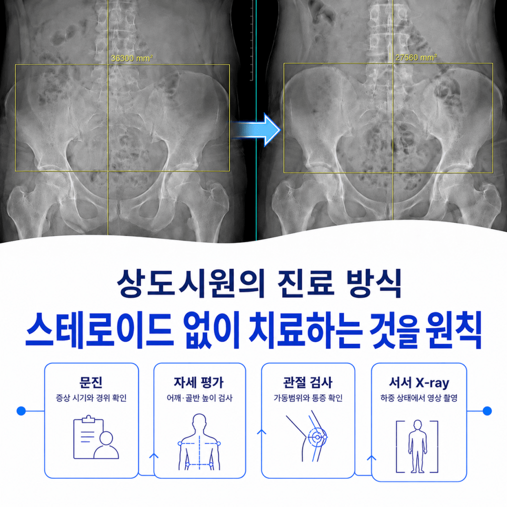 숭실대입구역 허리통증 진료에서 서서 X-ray와 자세 평가로 허리·골반·발목 관계를 확인하는 과정