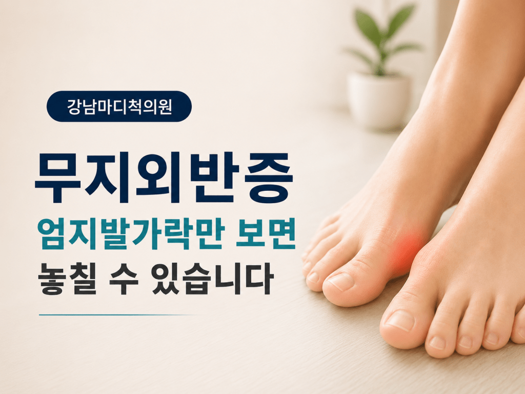 서귀포 법환동 무지외반증으로 엄지발가락 돌출을 확인하는 장면