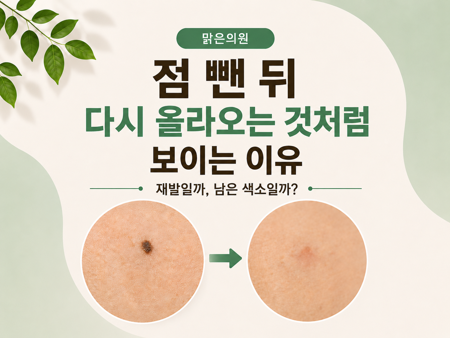 돌곶이역 점제거, 점 뺀 뒤 다시 올라오는 것처럼 보이는 이유