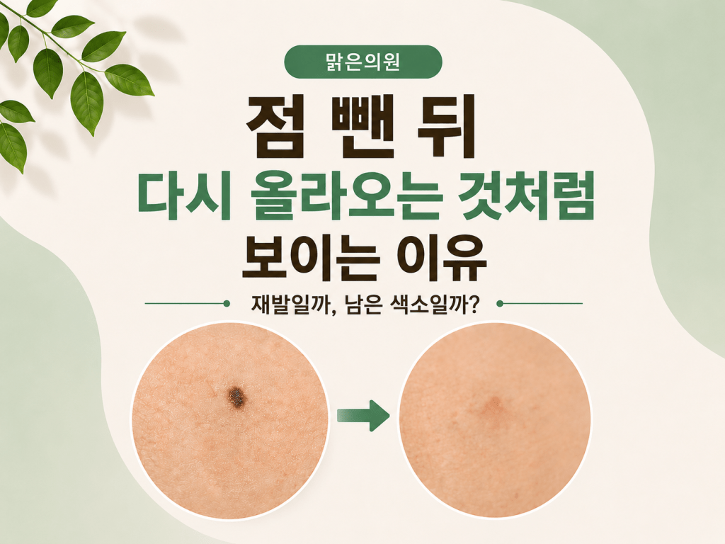 돌곶이역 점제거 후 다시 까맣게 보이는 피부 변화 안내'
