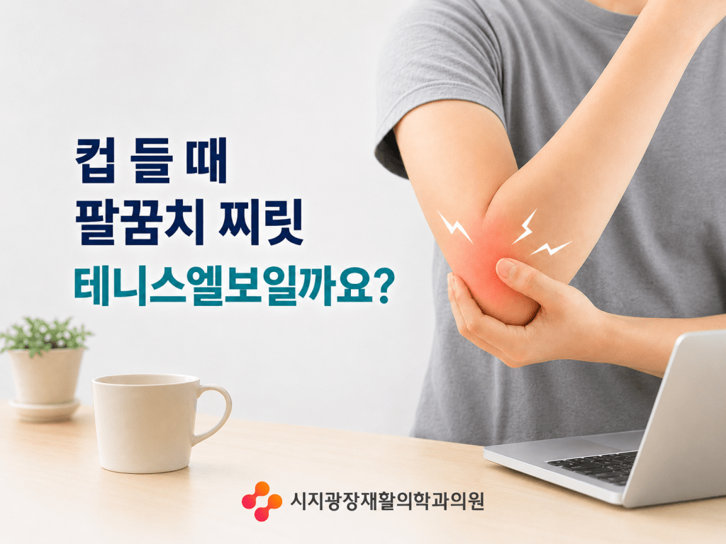 매호동 팔꿈치통증 컵 들 때 팔꿈치 바깥쪽이 찌릿한 테니스엘보 증상을 설명하는 시지광장재활의학과 썸네일 이미지
