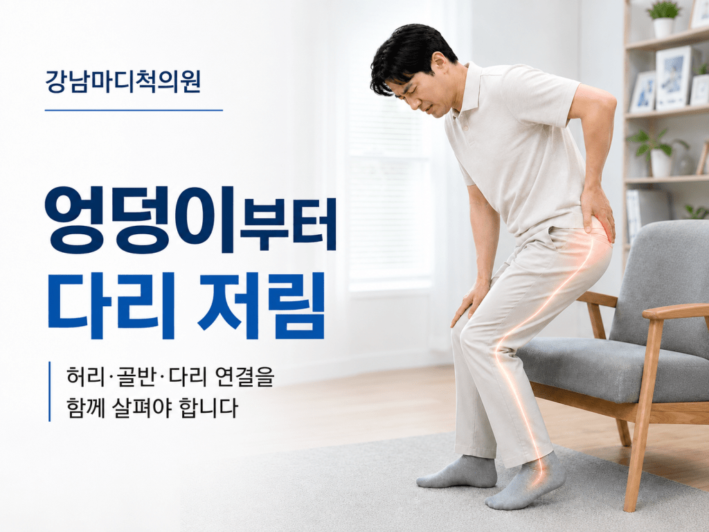 서귀포 대륜동 강남마디척의원 좌골신경통 엉덩이 다리저림 안내