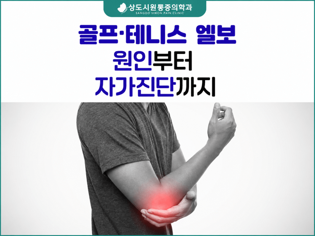 장승배기 팔꿈치 통증 골프엘보 테니스엘보 원인과 자가진단 안내 상도시원통증의학과