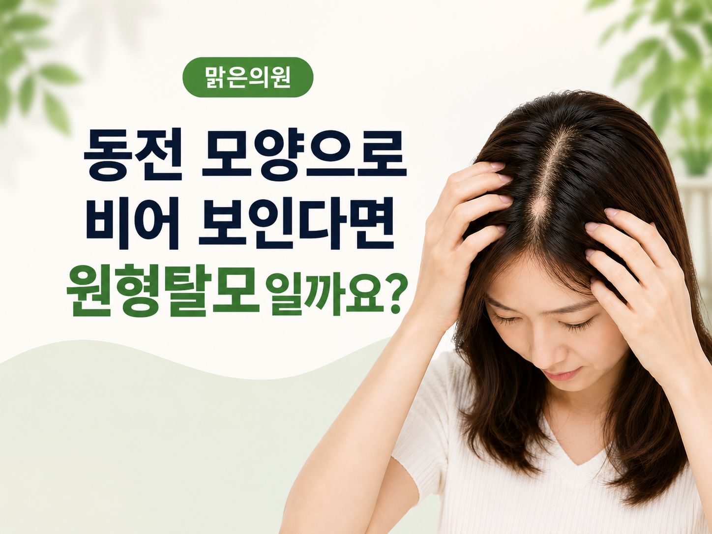 돌곶이역 맑은의원 동전 모양 탈모와 원형탈모 안내
