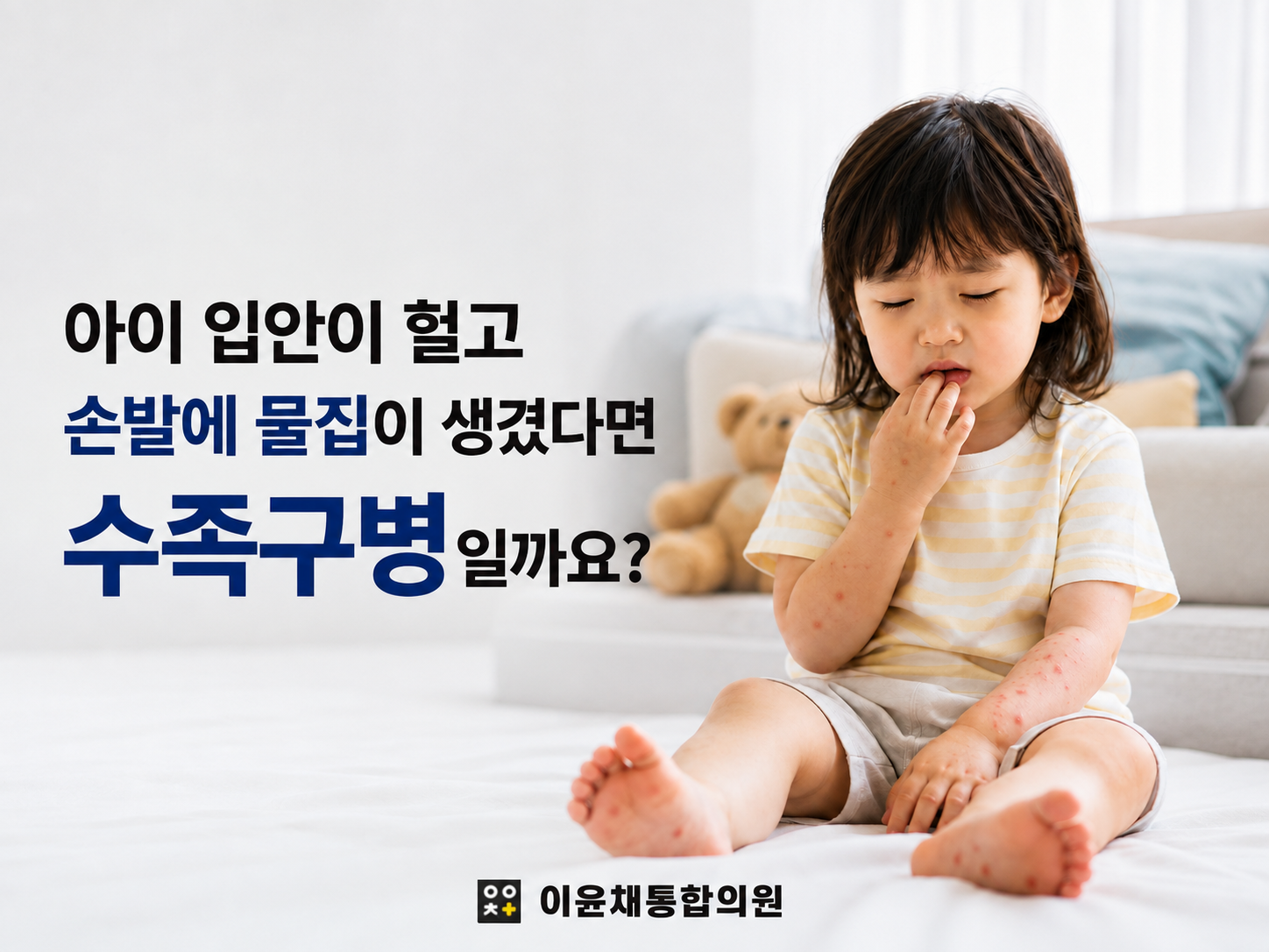 사수동 소아청소년과 아이 입안 궤양과 손발 물집 수족구병 안내